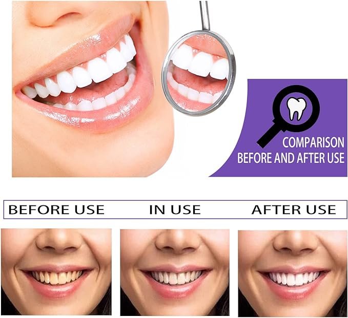 Purple Teeth Corrector-Whitening-Cleaning Toothpaste